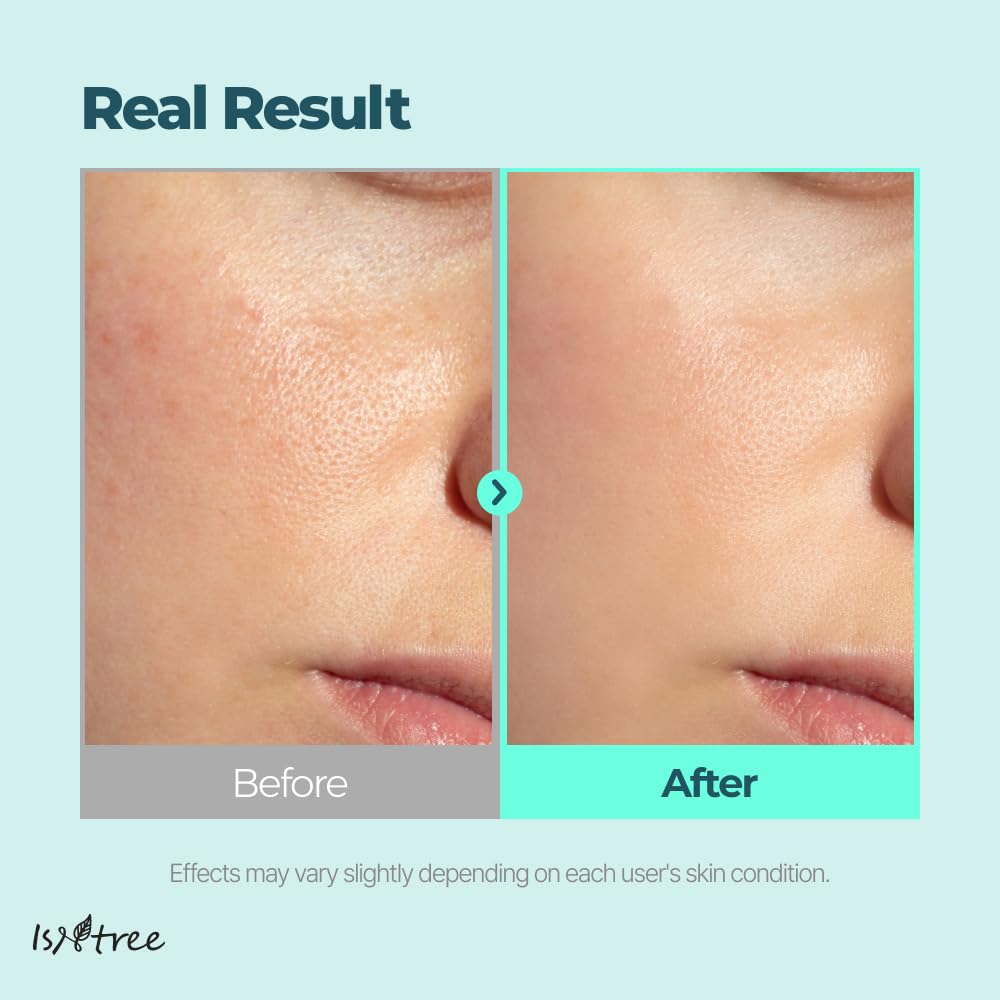 ISNTREE Gim PDRN Hydro Bouncy Ampoule 50ml, 1.69 fl oz | Korean SEAWEED Skincare Facial Serum | Water Jelly Texture | Hydrating & Firming | Multi-Hyaluronic Acid + Collagen Boost | Pore-Refining Glow