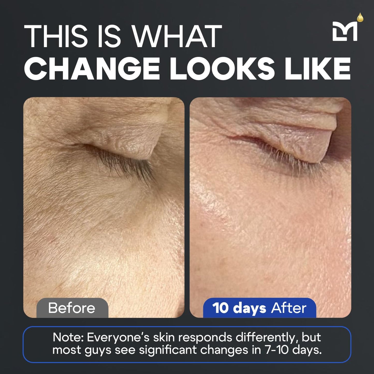 Titan Anti-Aging Peptides Serum for Face – High Potency Mens Peptide Serum Moisturizer – Mens Skin Care – Men, Dark Spots, Wrinkles, Fine Lines – Peptides, 5% Niacinamide, HA – Unscented