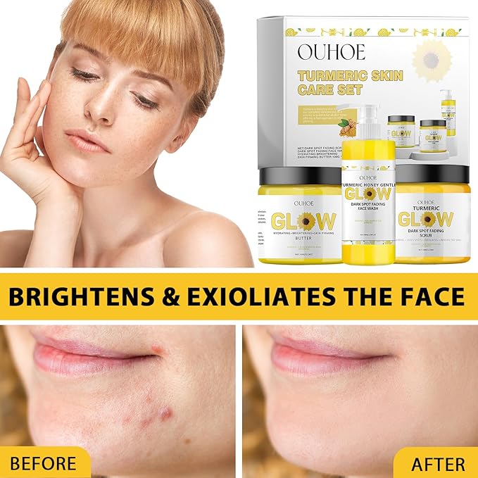Glow Combo Skincare Set,3 In 1 Turmeric Combo Skincare Set,Turmeric Glow Butter, Skincare Gift Set For All Skin Type (1 Set)