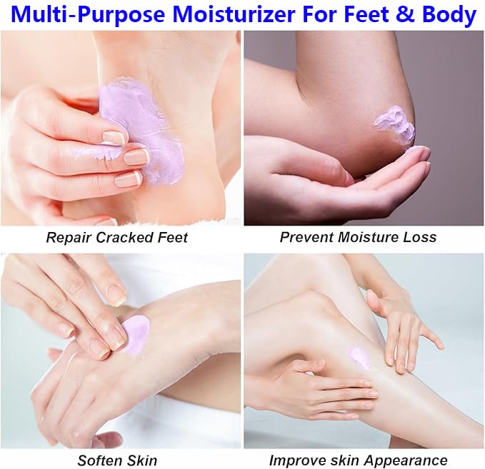 Urea Cream foot cream, 40 percent Foot Care Lotion for Cracked Heels,Moisturizing，Cracked Heels, Ultra,Rough, Dry, Calloused Feet,Softening Rough skin on feet for All Skin 5.29 fl.oz