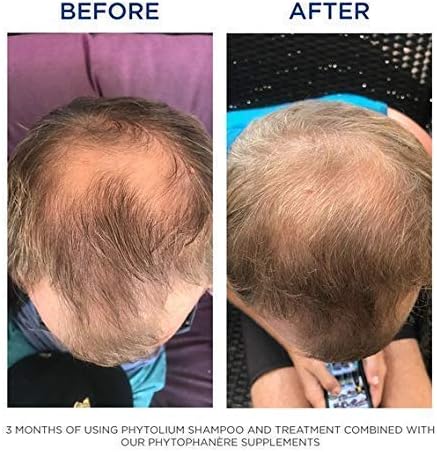 PHYTO Phytophanère 100% Natural Hair Loss Thinning Dietary Supplement, 4-Month Supply,Capsule, 120 Count (Pack of 2)