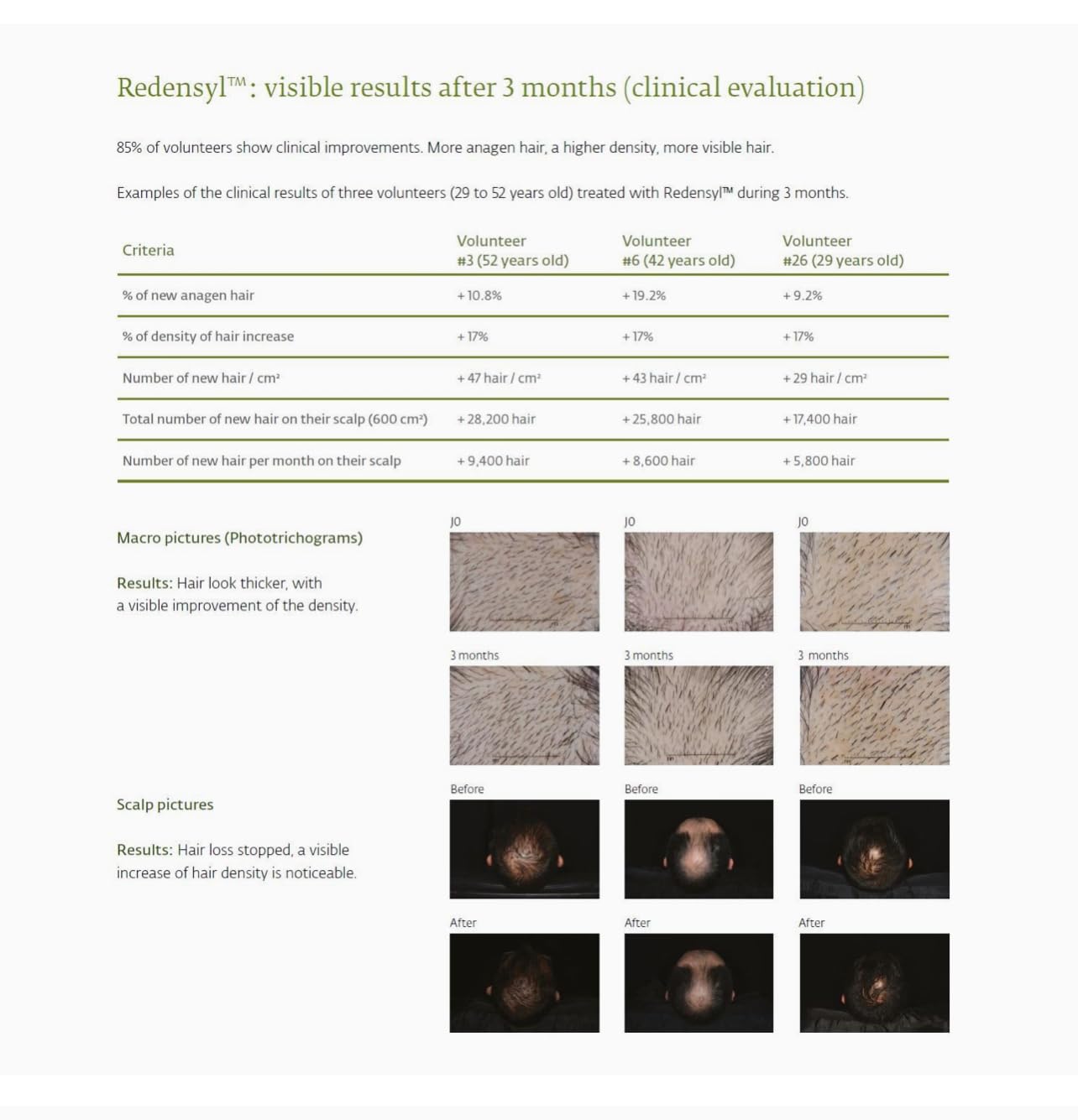 Avjou Researche™ Vitamin Mask – Supports the Look of Thicker, Fuller Hair – Vegan, Color & Keratin Safe, Hydrates & Strengthens with Redensyl™ – Designed for All Hair Types, 6 oz