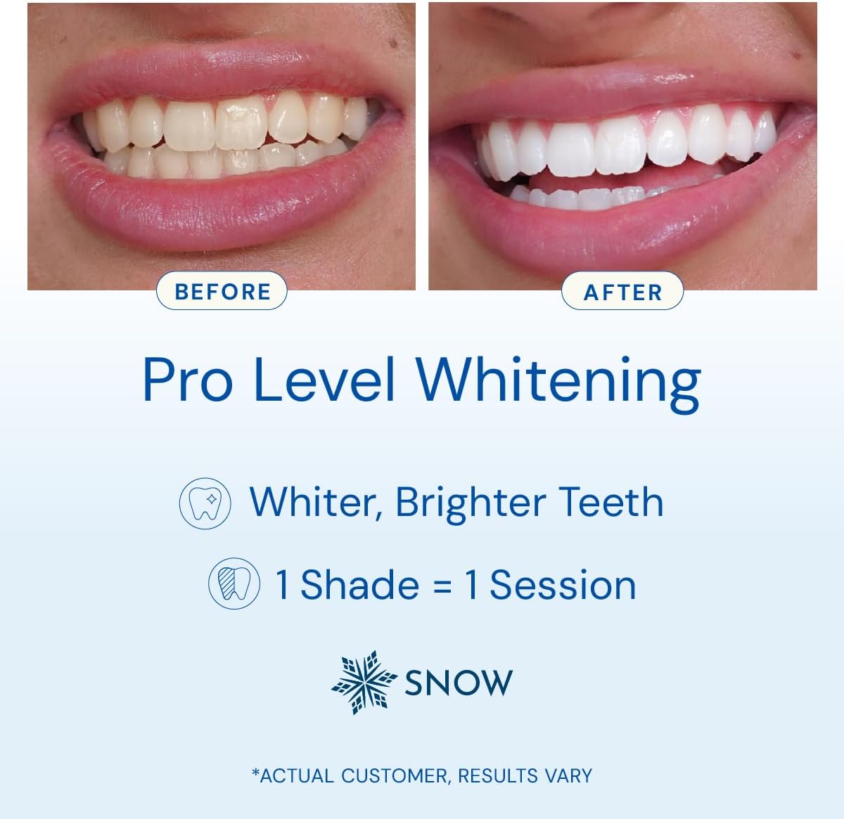 Snow Teeth Whitening Kit - Snow Teeth Whitening Serum and LED Mouthpiece Whitener, Formulated with Hydroxyapatite, Good for 6 Months - Wireless Kit with 3 Wands