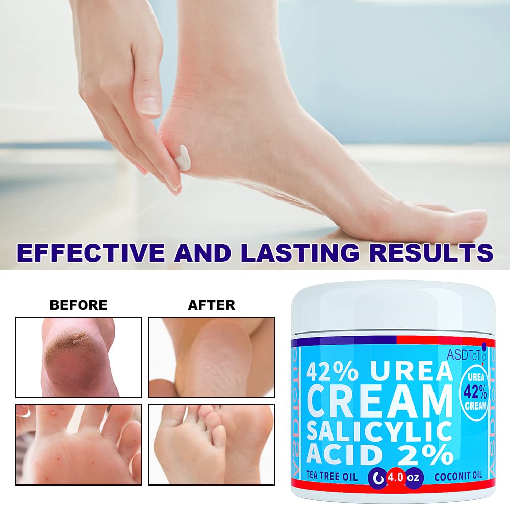 Urea Cream 42% - Premium Urea Foot Cream - With 2% Salicylic Acid, Tea Tree Oil, Shea Butter, Aloe Vera - For Feet, Hands, Heels, Elbows, Knees and More - 4 oz