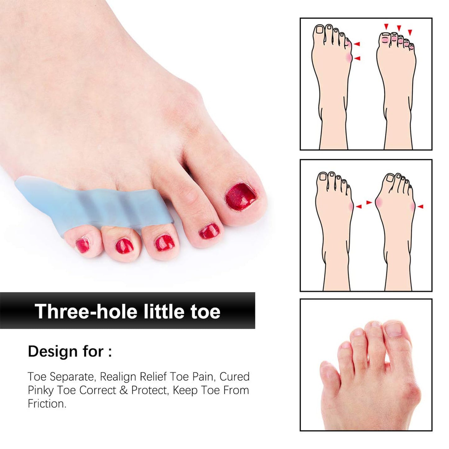 Toe Spacers, 5 Pairs Little Toe Separators Protector with 3 Loops for Curled Toes/Overlapping Toes/Foot Pain/Bunion Corrector and Bunion Relief for Men Women