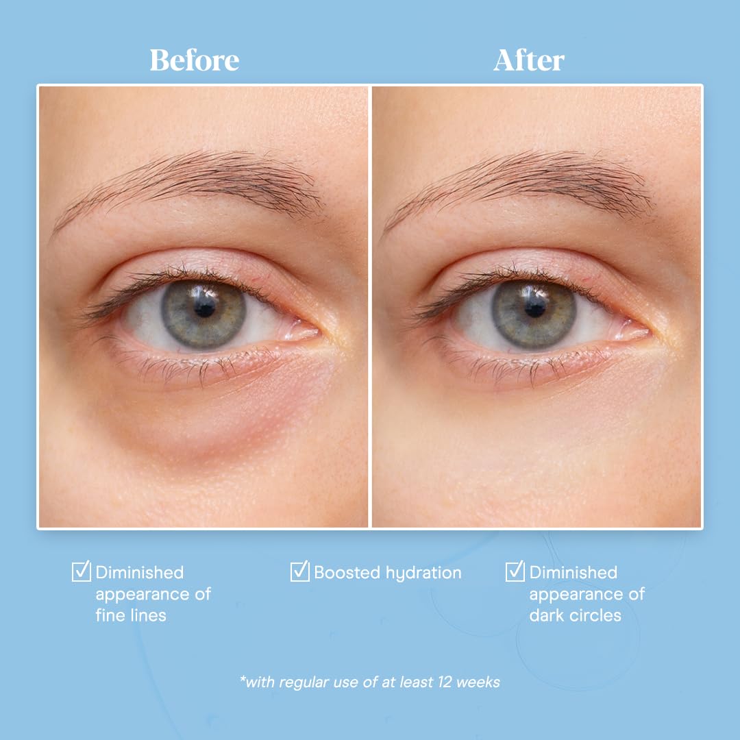 Baebody Snail Mucin Eye Cream (30 ml/1.06 fl oz) - Anti-Aging Eye Cream for Dark Circles and Dry Skin - Snail Mucin Serum with Peptides and Hyaluronic Acid