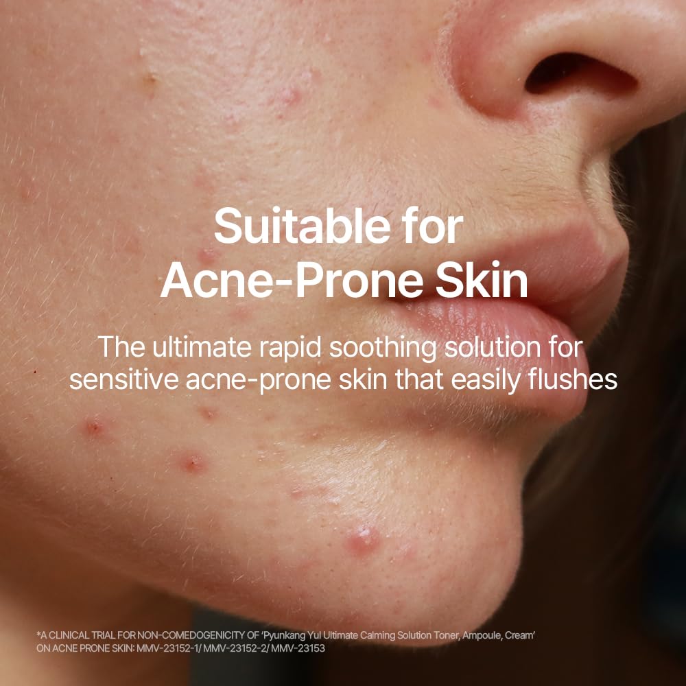 Pyunkang Yul Calming Line Gift Box Set-Korean Facial Skin Care Essential for Daily Moisturizing with Toner, Serum, Cream, Vegan & Cruelty Free Stocking Stuffer Christmas Holiday New Year gift set