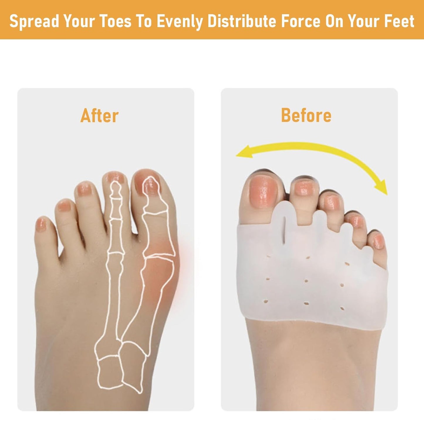 YIKESHU Silicone Toe Separators with 2 Pairs Toe Socks for Women, Toe Straightener, Yoga Toes Toe Separators for Overlapping Toes to Foot Pressure Relief (2pairs toe separators + 2pairs toe socks)