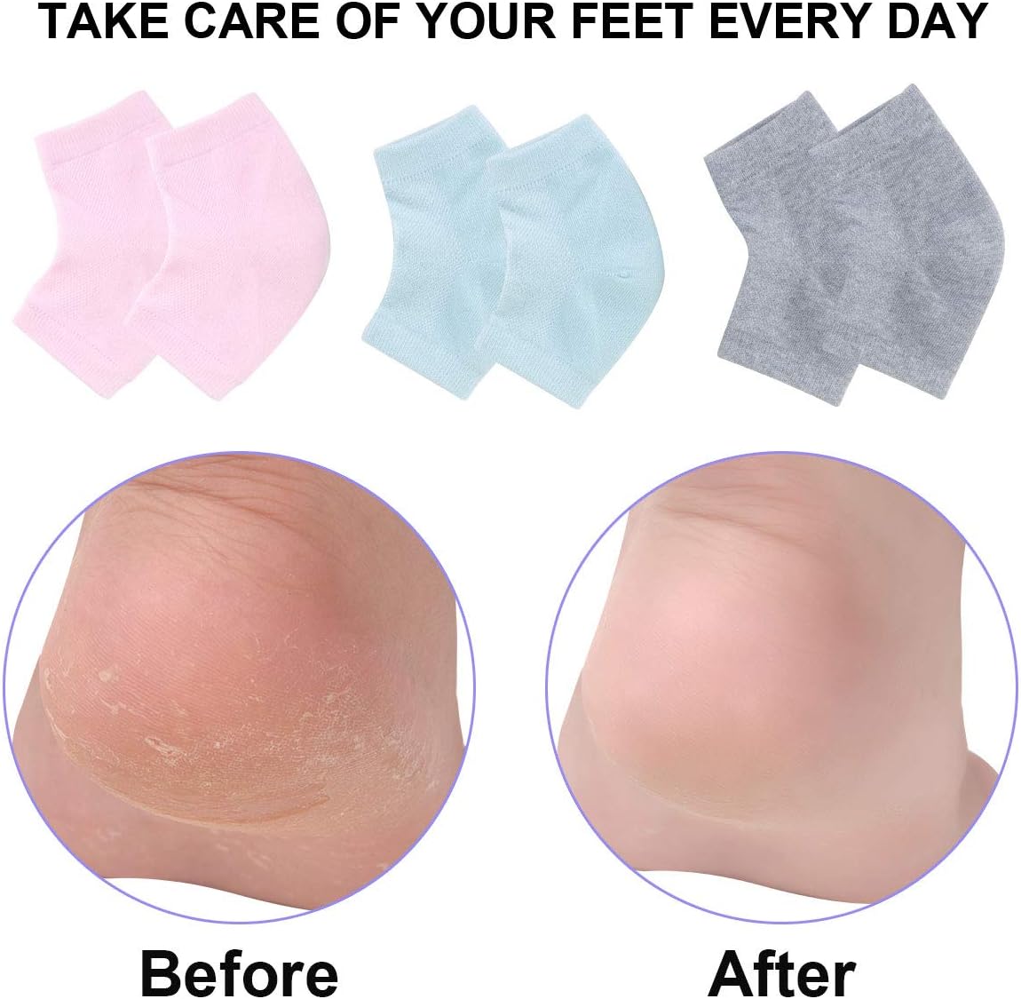 Vented Moisturizing Gel Heel Socks, 3 Pairs Toeless Spa Sock for Foot Care Treatment, Cracked Heels, Dry Feet, Foot Calluses (Gray, Green, Pink)