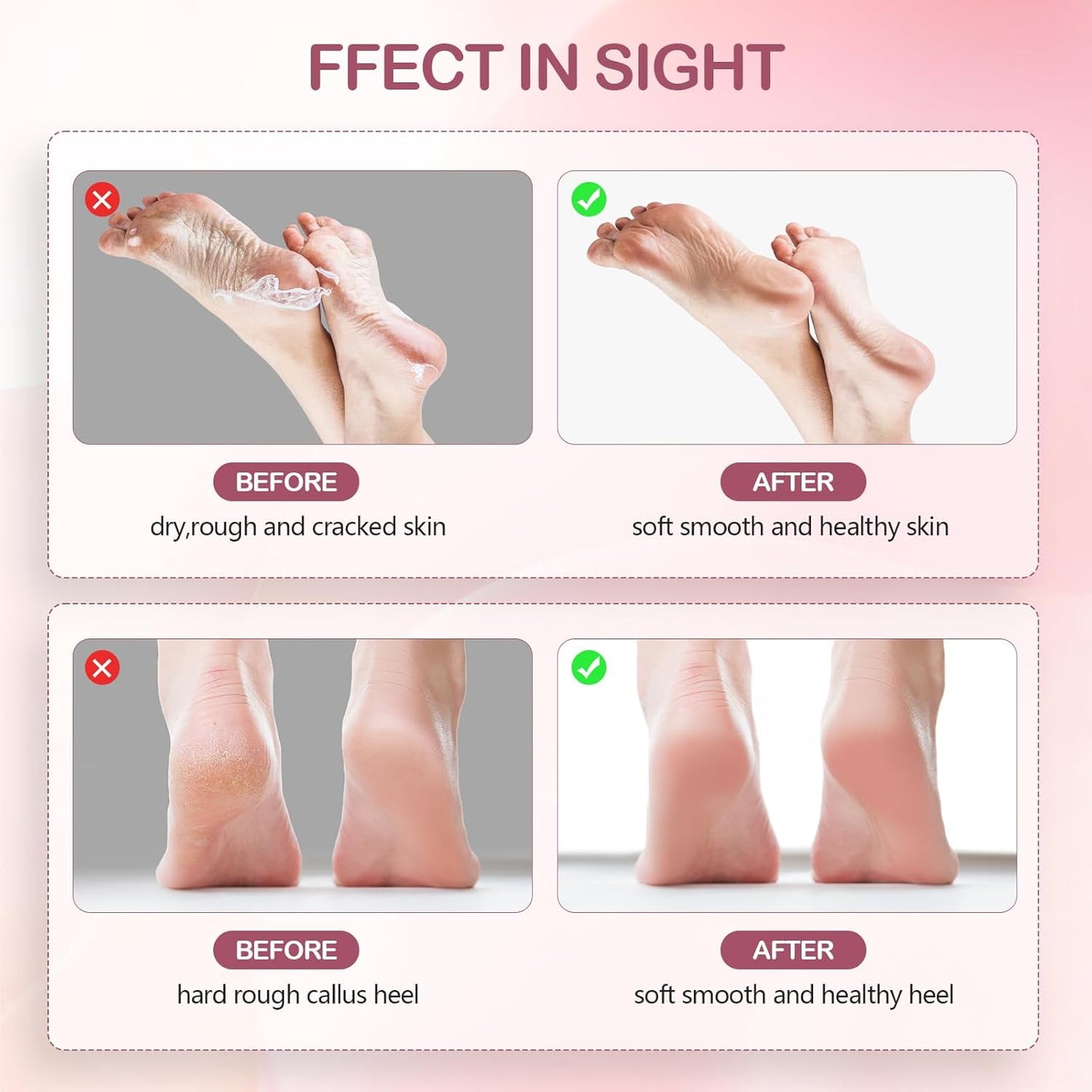 Cordless Electric Foot Callus Remover,Rechargeable Grinder Tool for Feet Dead Skin,Professional Pedicure File Heel Sander with 60pcs Replacement Sandpaper Pads(Pink)