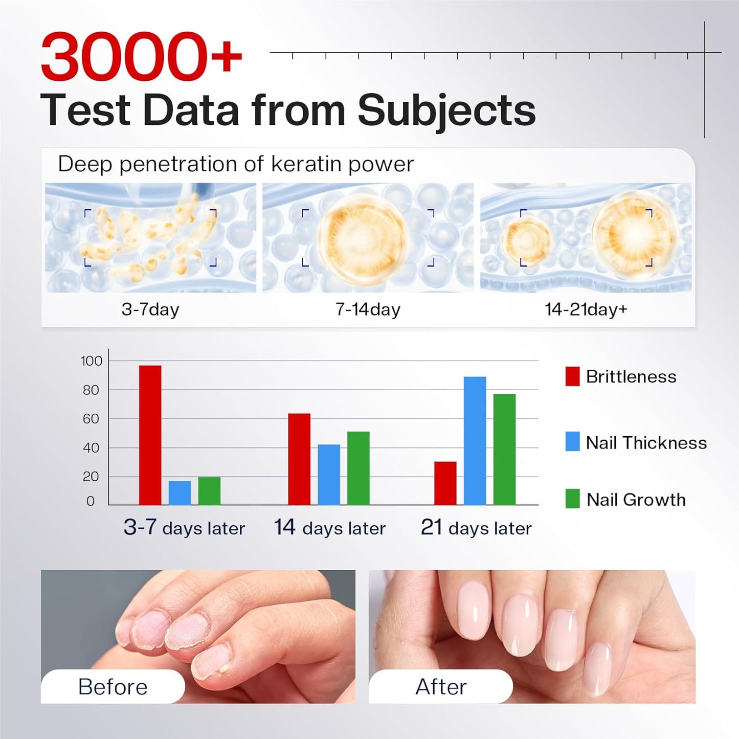 Morovan Nail Strengthener and Growth: Nail Polish Hardener for Damaged Nails Treatment Natural Keratin Repair Ridge Filler Prevents Discoloration Crack Thin Essential Manicure Nail Care Women