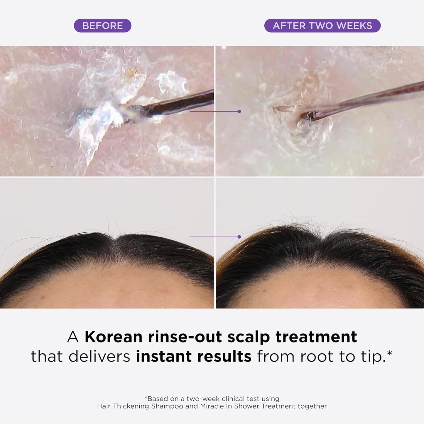 Dr. Groot Miracle in Shower Treatment, Korean Hair Care, 5 Seconds to Smooth Hair, Rosemary Oil for Healthier-Looking Hair, Hair Rinse, Moisturizing Hair Treatment, Kbeauty Scalp Revitalizing Solution