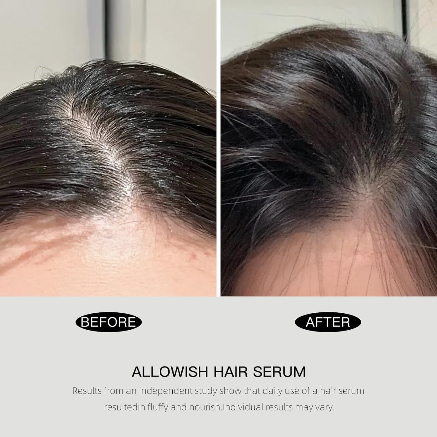 Advanced Hair Serum - 95 ml Scalp Treatment for Fuller, Nourish, Glossy Hair | Prevents Frizz, Promotes Healthy Scalp & Strengthens Roots, Reduces Oil & Buildup