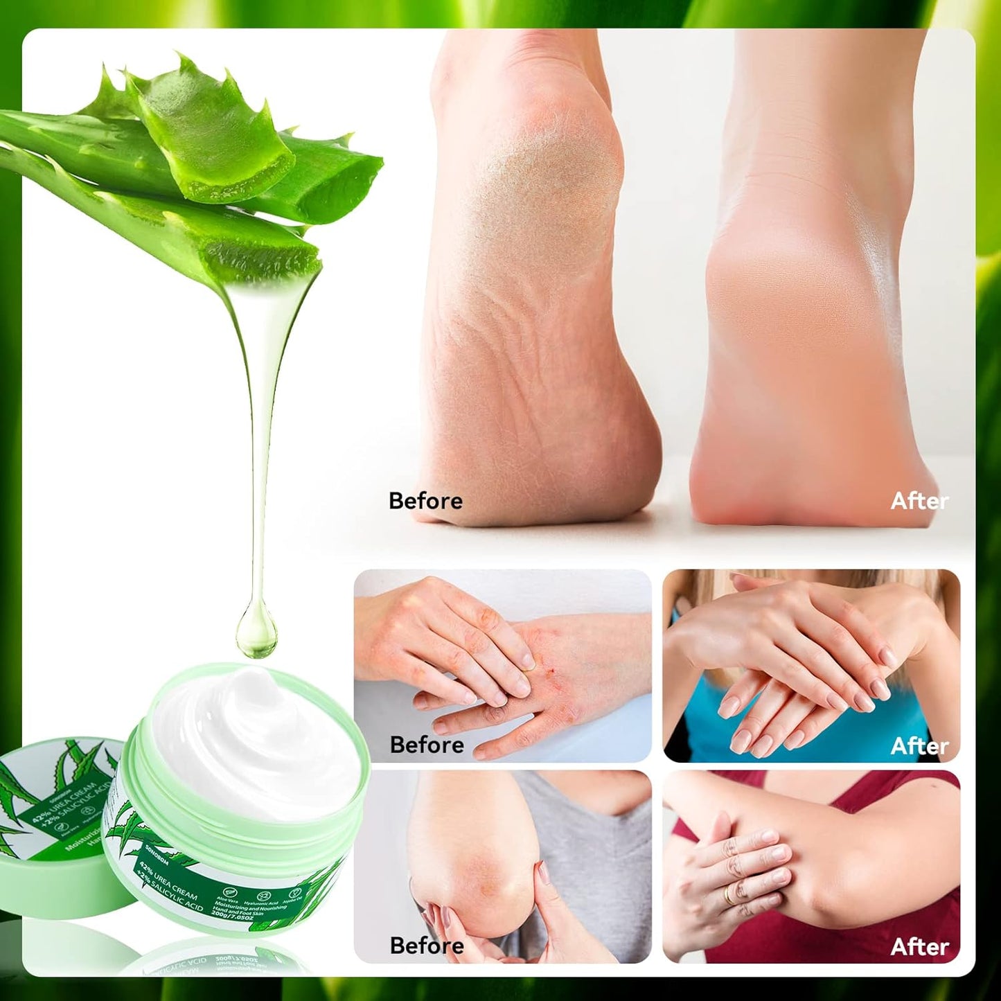Urea Cream 42 Percent for Feet 7.0 Oz, 2% Salicylic Acid, Aloe Vera, Hyaluronic Acid , Deeply Moisturize Skin Cream For Dry Cracked Feet, Hands, Heels, Elbows, Nails, Knees, Intensive Moisturizes &