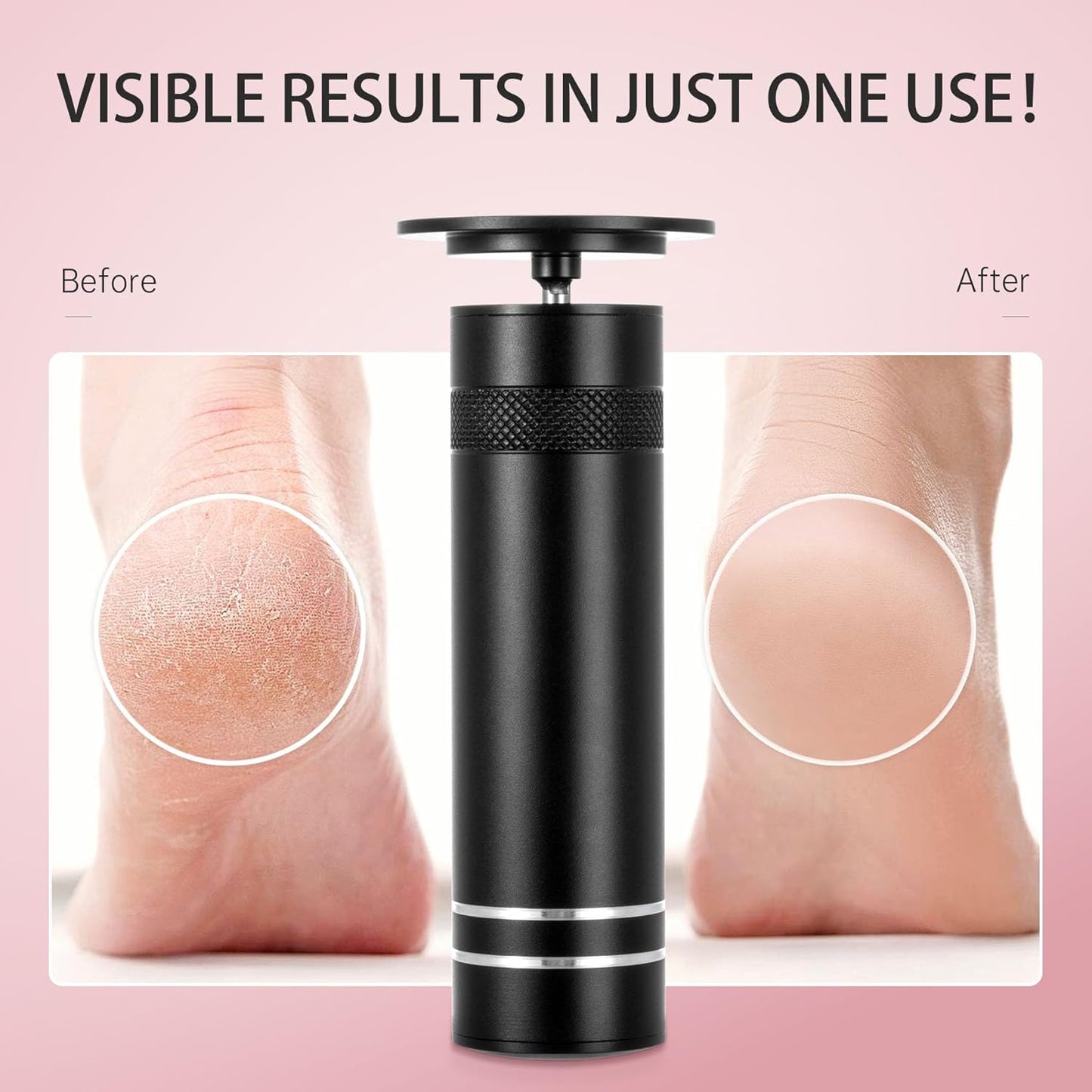 FSA&HSA Eligible Electric Foot Callus Remover with 60pcs Sandpaper Discs, Professional 1200RPM Aluminum Callus Remover for Feet, Stepless Speed Control Foot File for Dead Skin (Black)