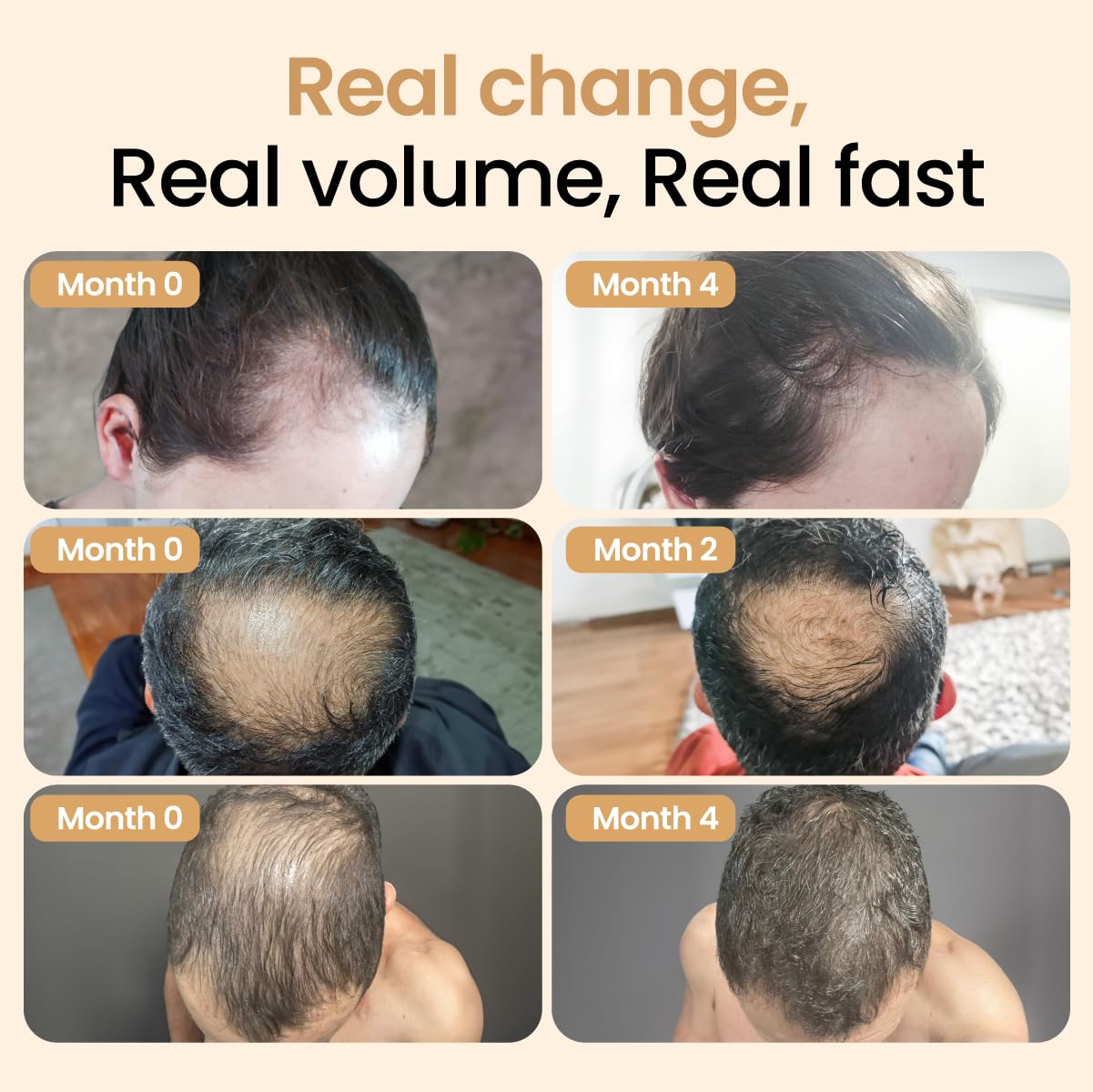 Hair Booster for Women & Men – Hair Revitalizing Serum with Capilia Longa & Arginine for Thick, Dry, Long, Damaged Hair – Peptide-Enriched Hair Tonic, 2 Fl Oz - Pack of 3