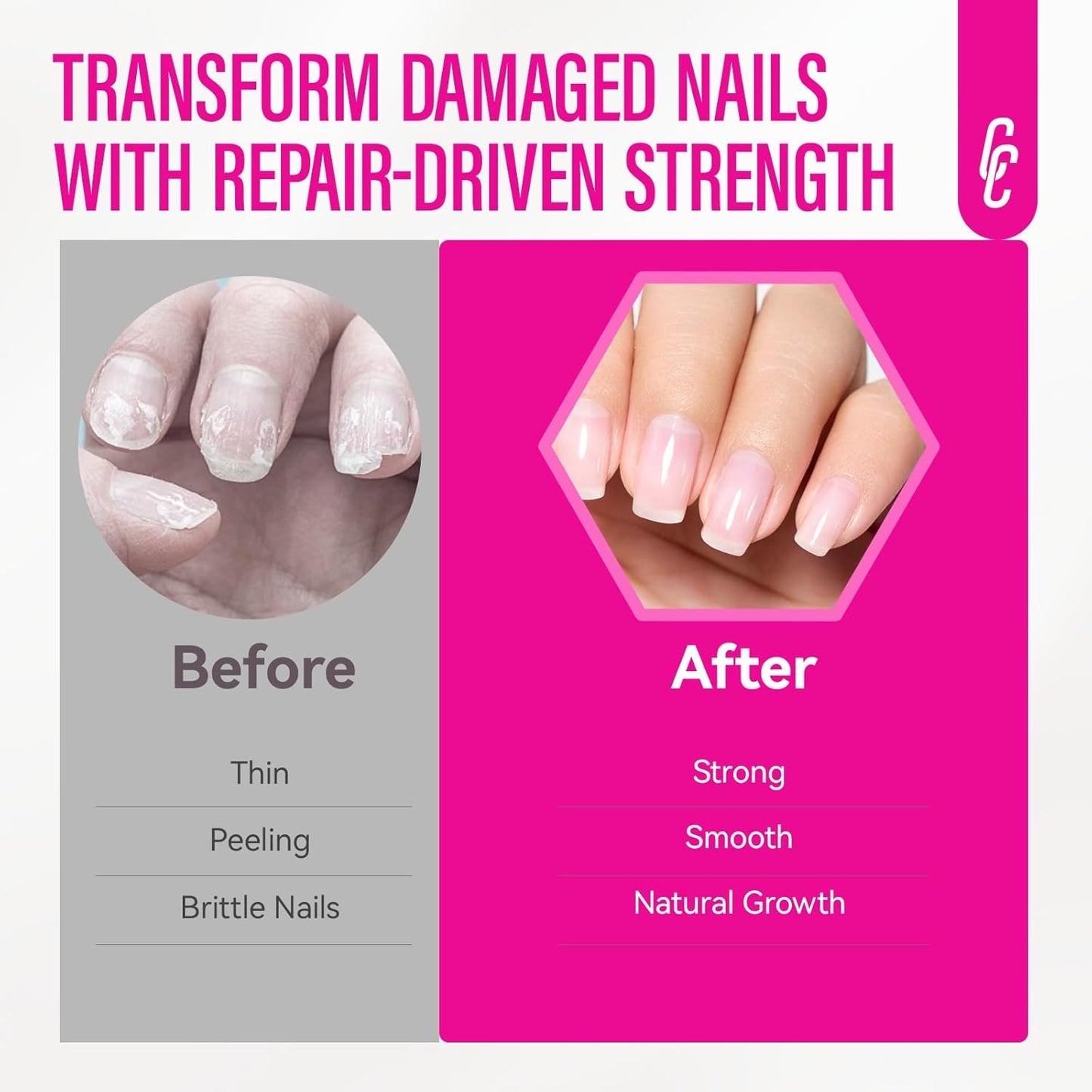 CHUCHU Nail Strengthener Base Coat: Quick Dry Protein Clear Hardener Polish - Repair Ridge Filler for Women Men Beginners Home Salon Gift - 15ML