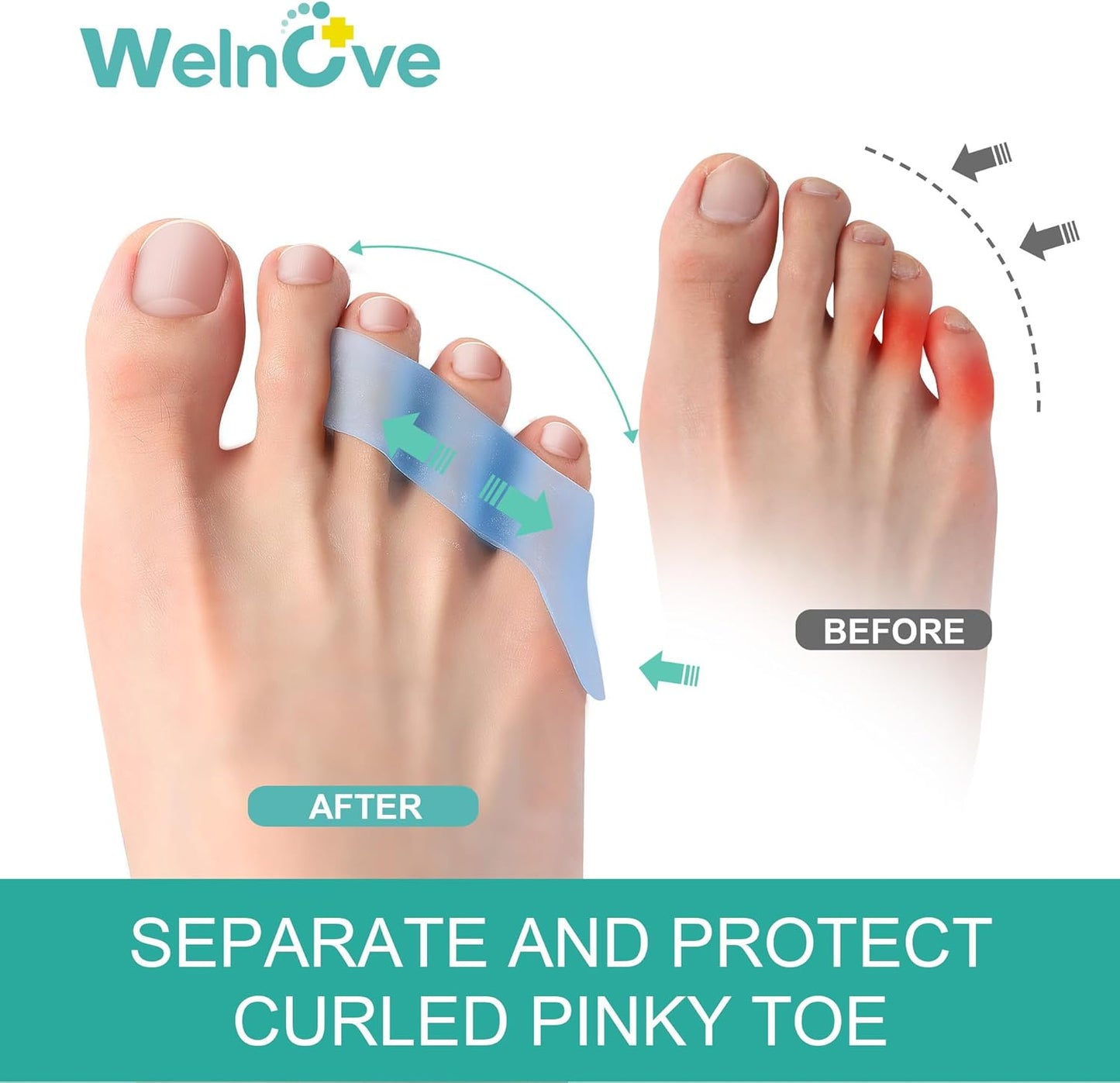 Welnove Gel Pinky Toe Separators - 8 Pack Pinky Toe Spacers, Bunion Cushions Pads for Women＆Men, Silicone Little Toe Protectors for Preventing Rubbing & Relieve Pressure(Blue)