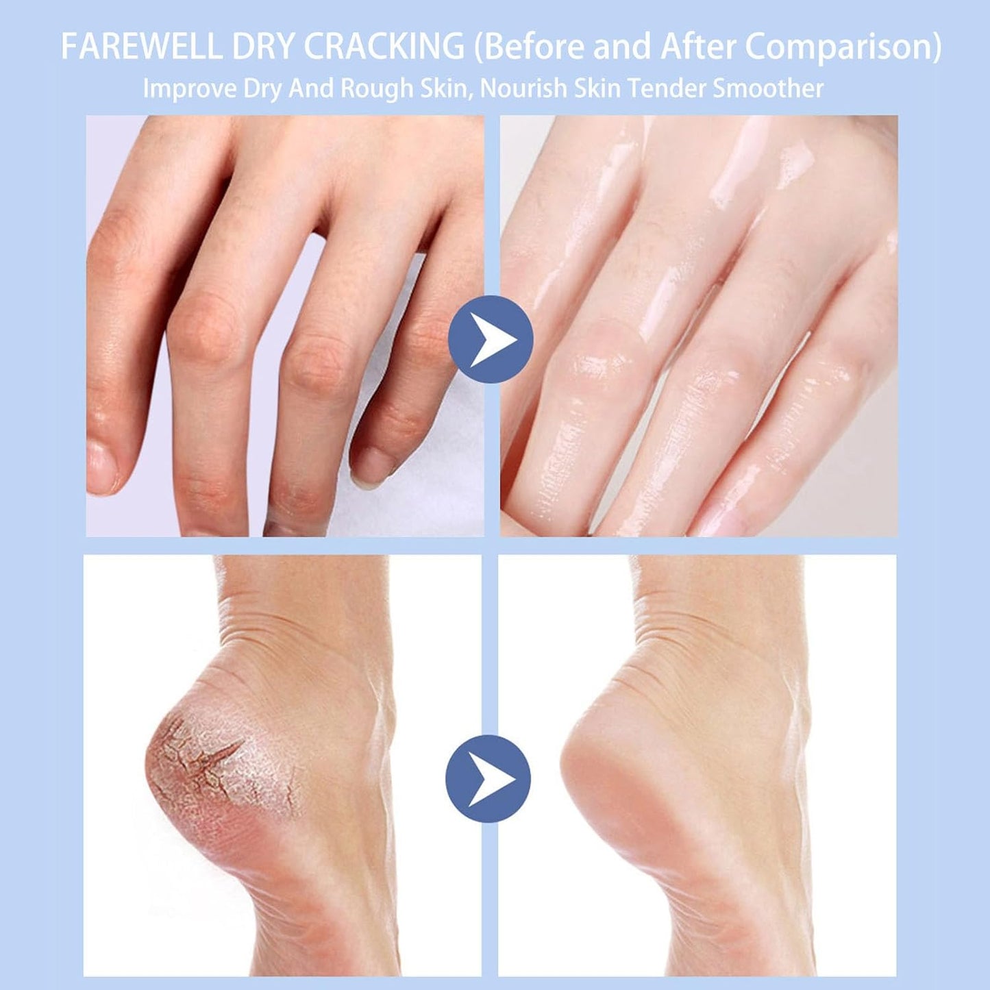 Crack Feet Prevention Stick 2PCS - Foot Care Cream Heel Balm for Dry Cracked Feet, Remove Dead Skin and Moisturize Dry Skin for Face, Knees, Elbows, Hands (2pcs, Strawberry + Blueberry)