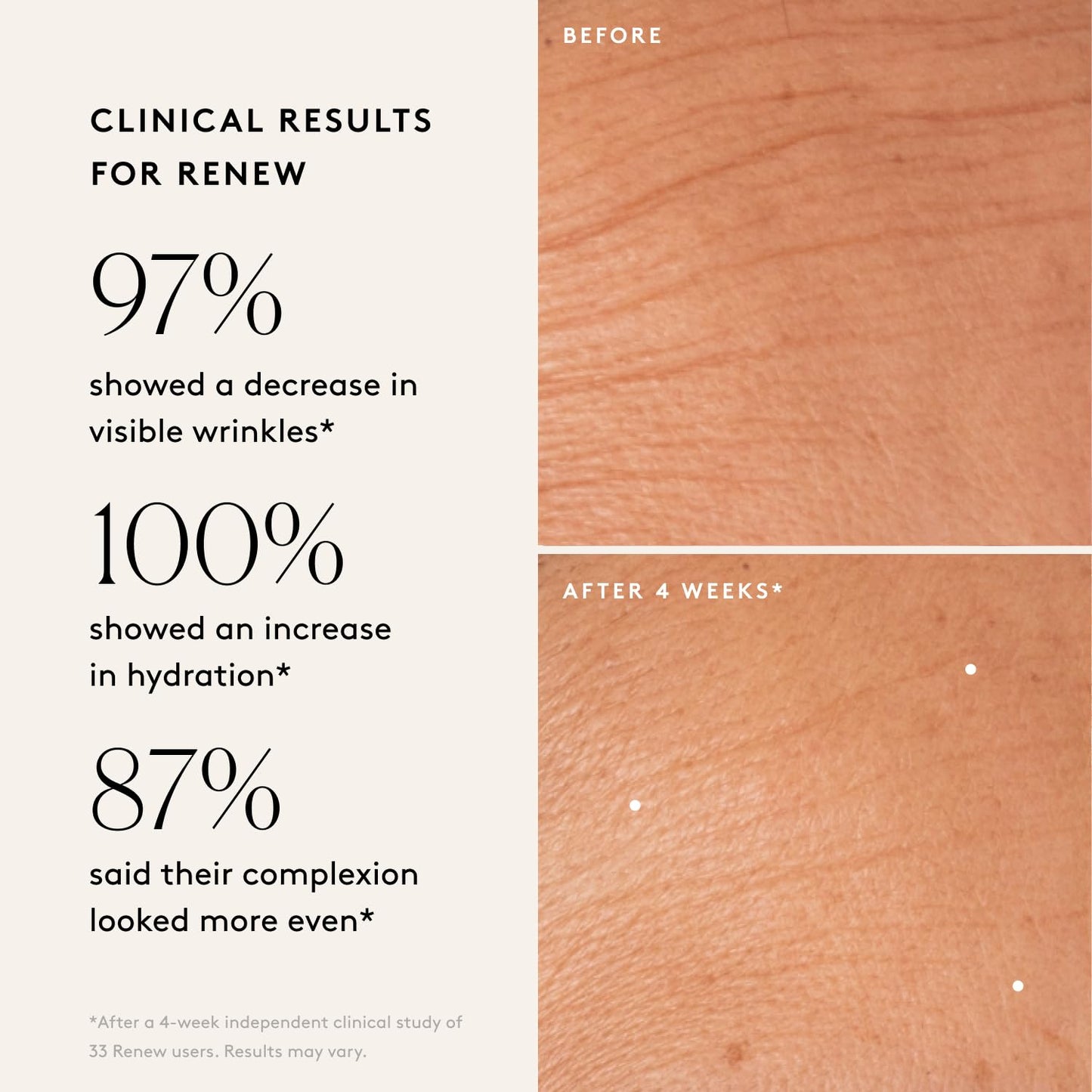 Naked & Thriving Wrinkle-Fighter Set, Includes Renew Resurfacing Night Serum (30 mL) & Illuminate C+ Serum (30 mL), Clinical Results, Dermatologist Loved, Hylauronic Acid & Bakuchiol (Set of 2)