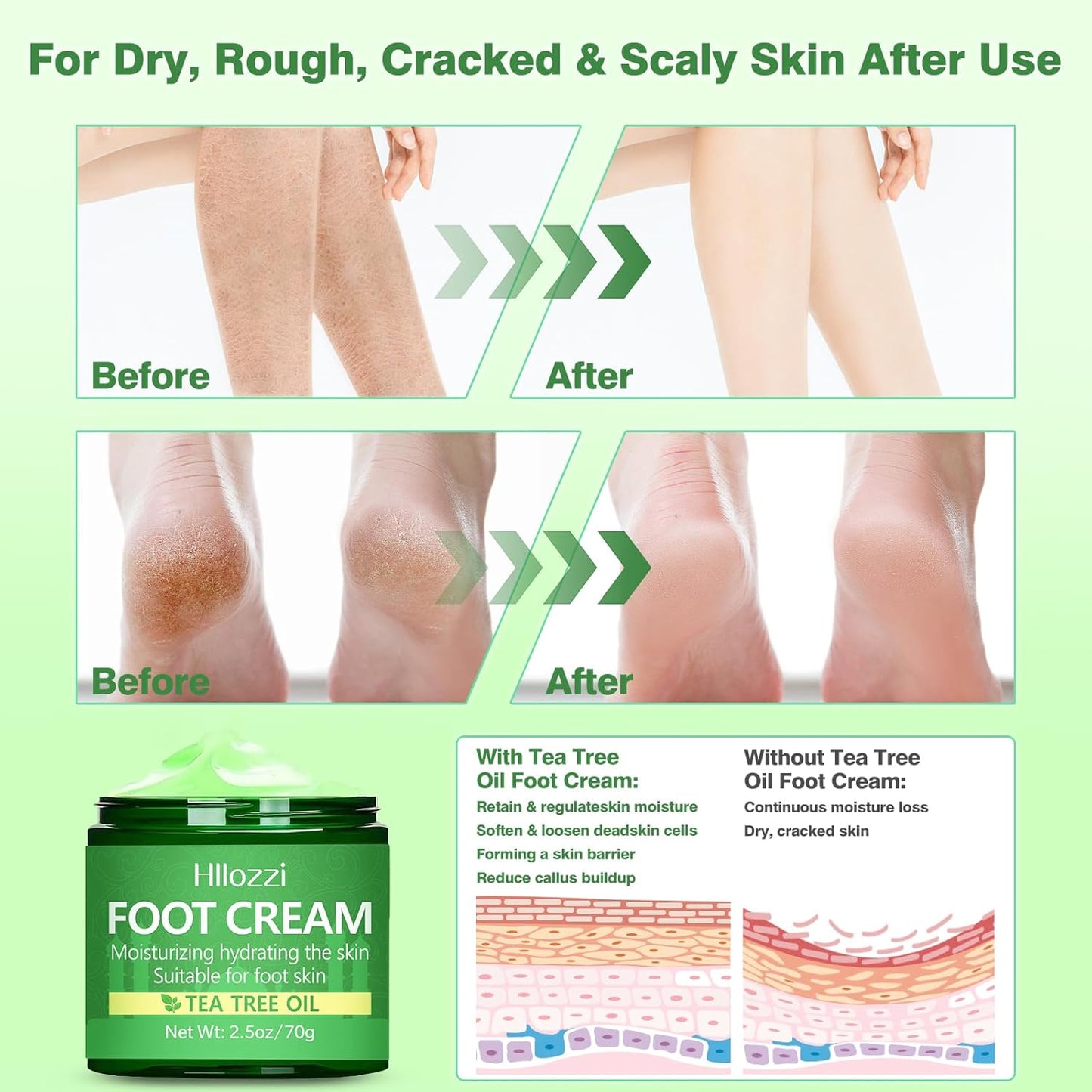 Tea Tree Oil Foot Cream for Dry Cracked Heels and Feet, Ultra-Hydrating Softening Foot Cream, Moisturizes for Healthy Feet, 2.5 oz