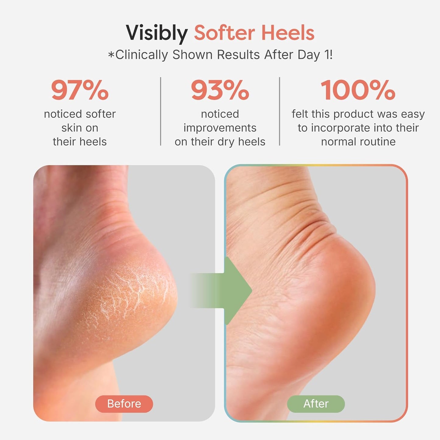 ZenToes Moisturizing Socks for Cracked Heel Treatment - Vitamin E, Olive Oil and Jojoba Oil Infused Heel Socks to Soften and Hydrate (Fuzzy Black, Wide Width)