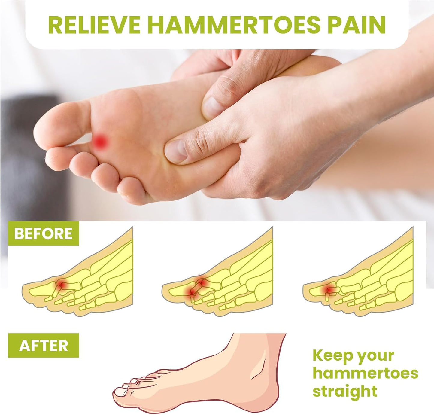 Bukihome Hammertoe Corrector Gel Toe Straighteners - 12 pcs Support Crest for Women & Men - Realign Bent, Crooked, Curled, Claw, Hammer Toes - White,Multi-Size