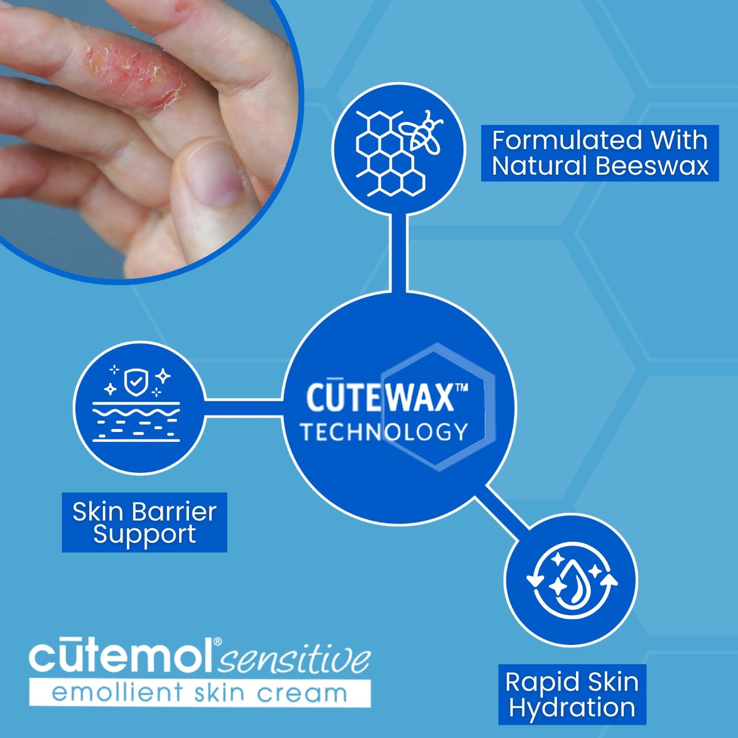 Cutemol Emollient Moisturizer for Sensitive Skin - Serious Moisturizing Cream for Damaged Skin Recovery - Fragrance Free Hydration for Cracked Hands & Feet, Eczema, Psoriasis & Dry Skin (2.75 oz)