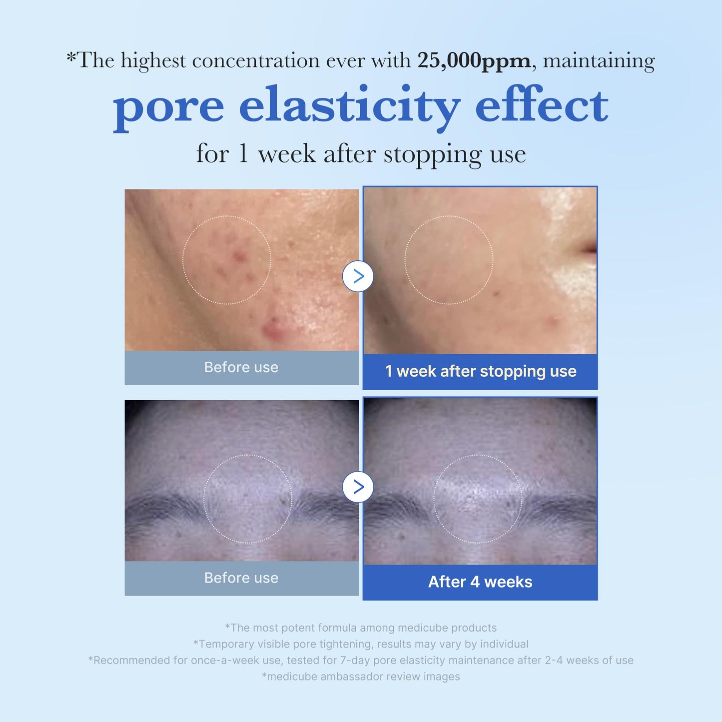 medicube Zero Exosome Shot 7,500 PPM Spicule Facial Serum | Liquid Skin Booster Serum | Exosome, AHA+BHA+PHA | Pore Care, Dead Skin Cells, Skin Texture | Korean Skin Care 1.01 fl.oz