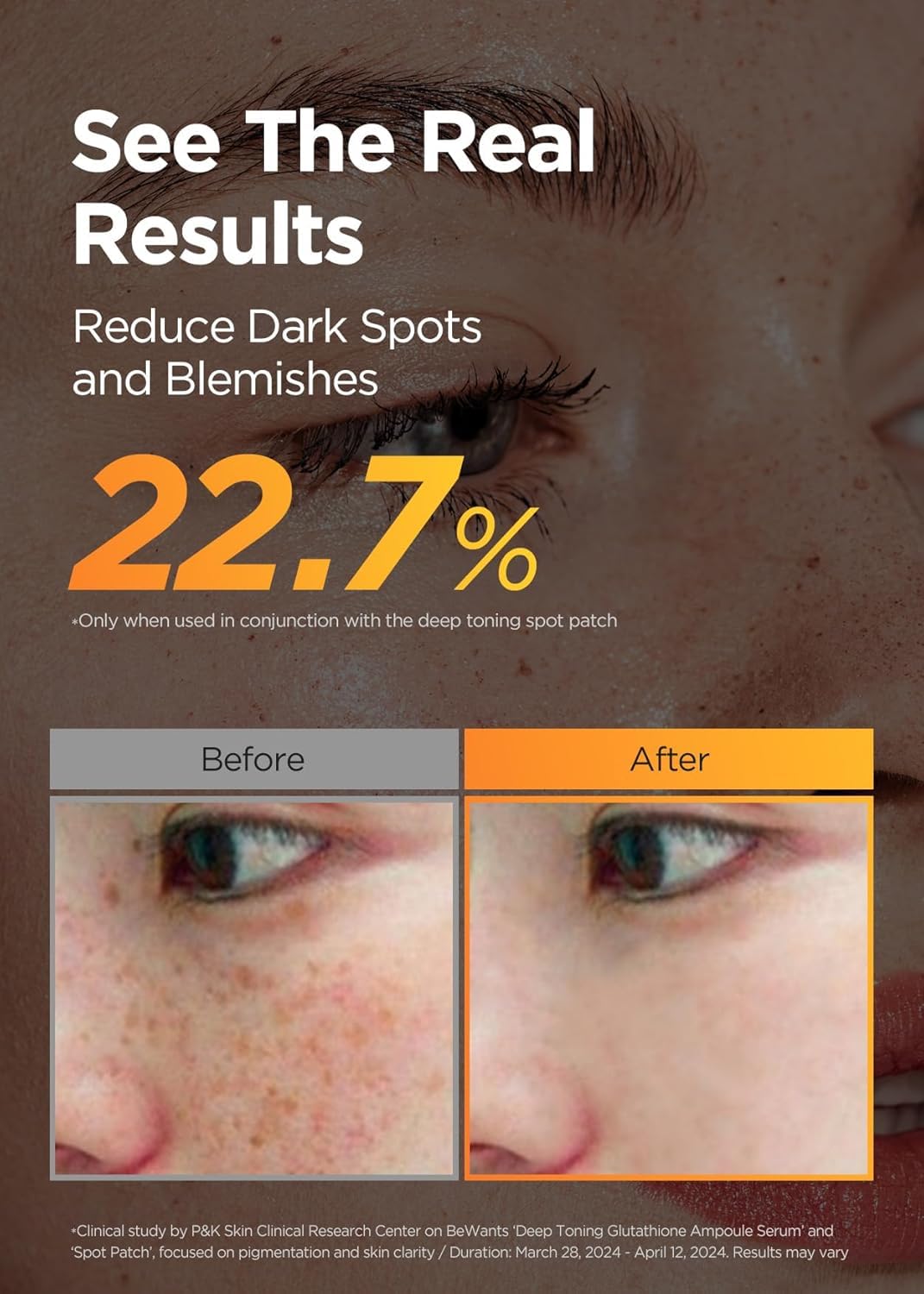 [K-Beauty] Bewants Deep Toning Glutathione Ampoule Serum | Korean Skincare with Vitamin C & Calendula Extract, 1.01 fl.oz & Bewants Deep Toning Glutathione Spot Patch