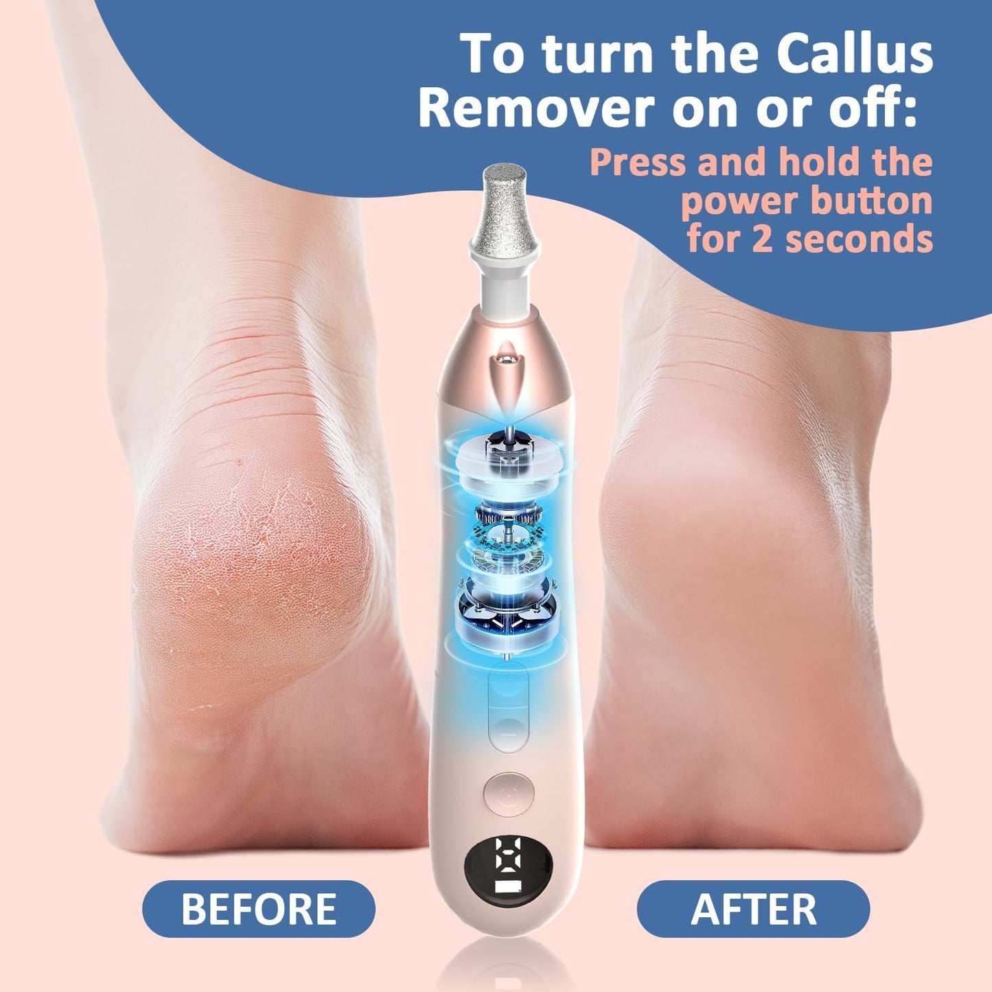 Callus Remover for Feet, Electric Foot Callus Remover - 8 Grinding Heads, 9 Speeds, Rechargeable Foot File - Professional Pedicure Tool for Hard Skin, Calluses & Cracked Feet
