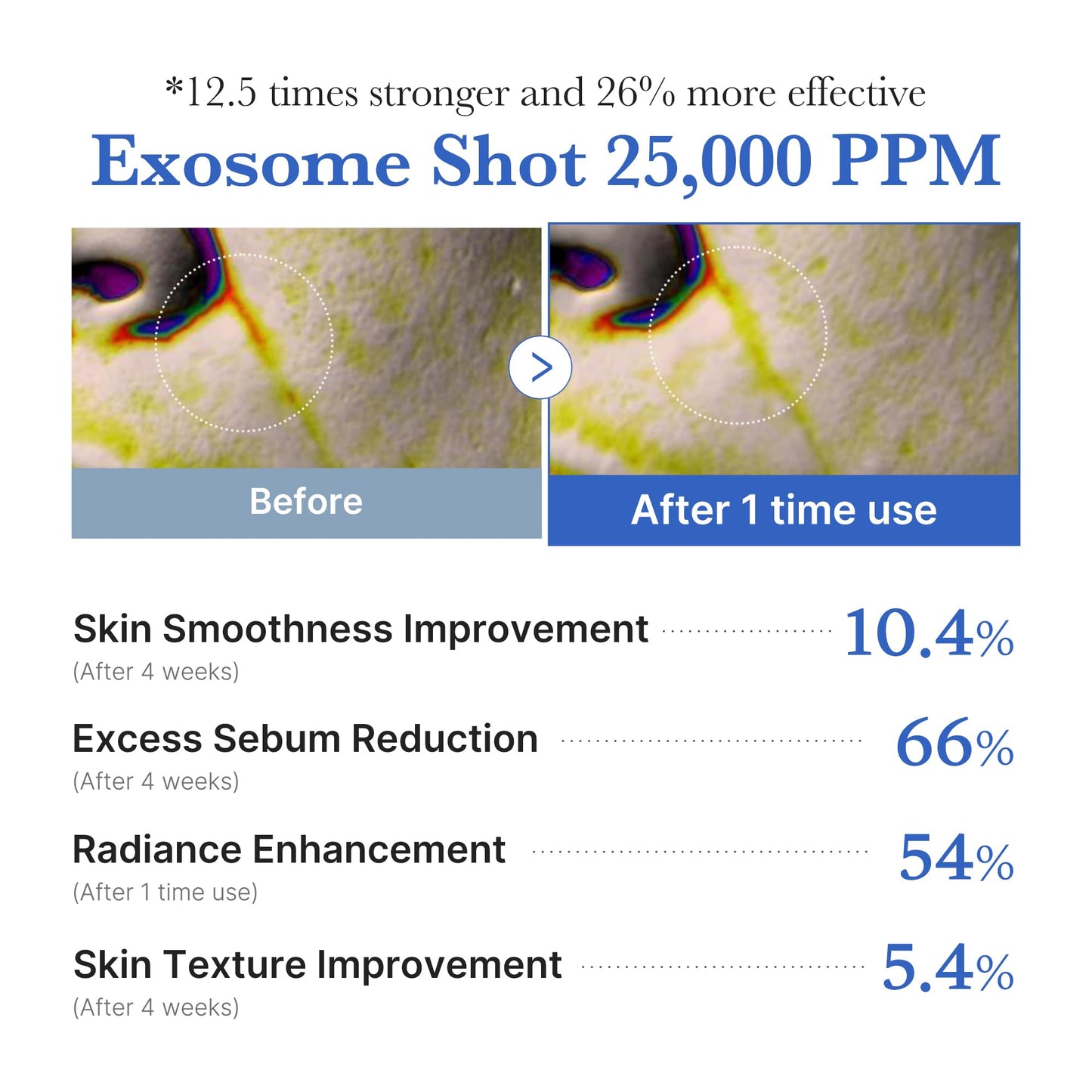 medicube Zero Exosome Shot 7,500 PPM Spicule Facial Serum | Liquid Skin Booster Serum | Exosome, AHA+BHA+PHA | Pore Care, Dead Skin Cells, Skin Texture | Korean Skin Care 1.01 fl.oz