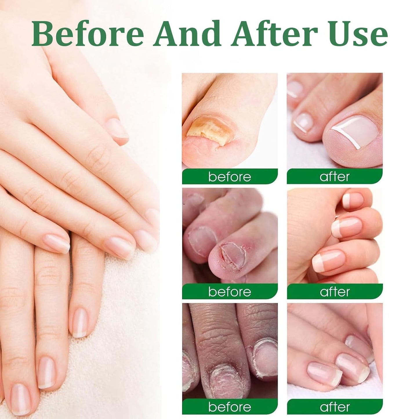 Nutraboost Nail Treatment Gel, Nail Growth Serum for Repair & Strengthener, Multi-Purpose Nail Repair Serum (1)