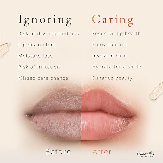 CHAP-LIP Original Lip Balm Hydrating Bulk Chap Stick with Fruit Flavors, Coconut Oil, and Cocoa Butter - Lip Therapy Pack for Men and Women - Gift Set Made in the USA, 60 Pack