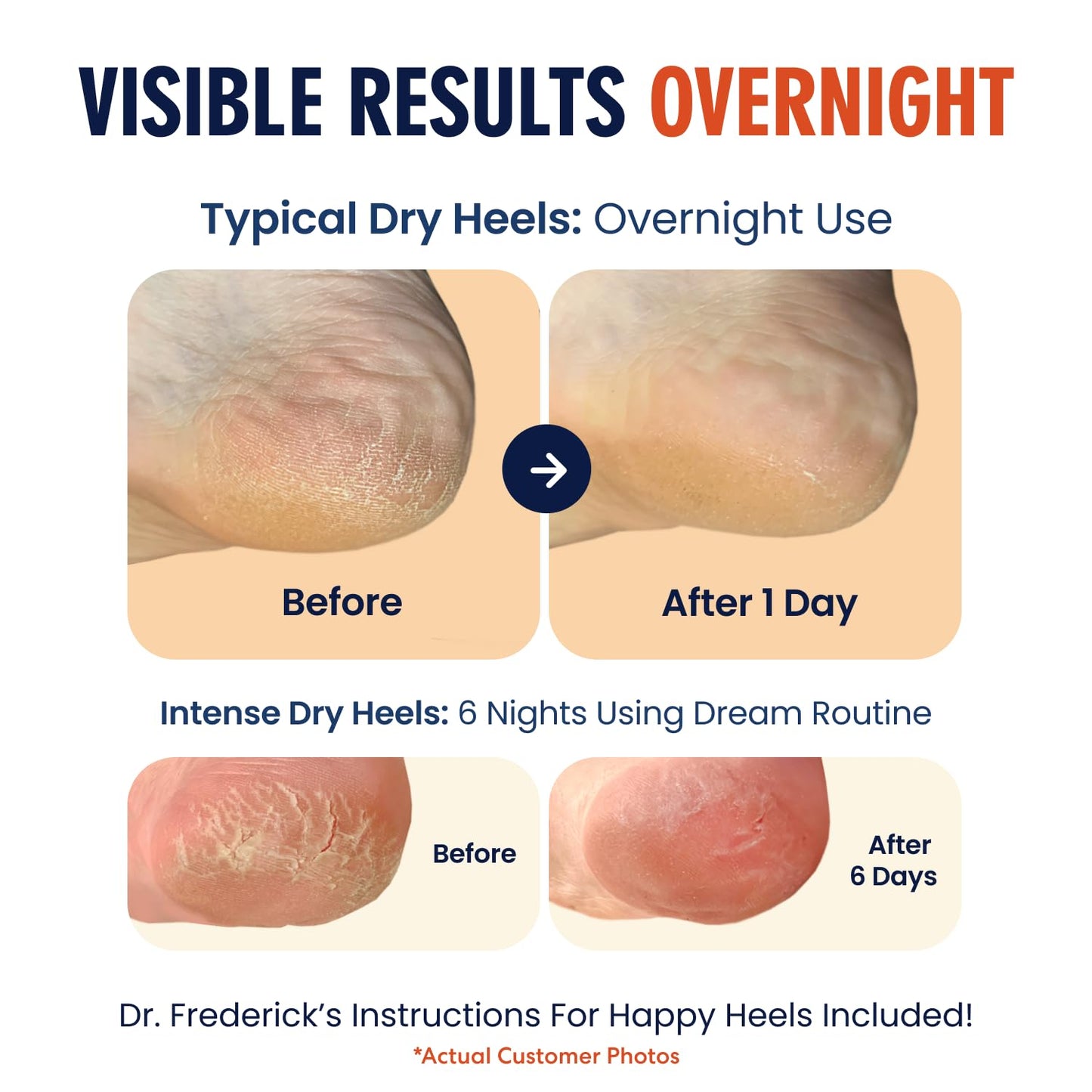 Dr. Frederick's Original Moisturizing Heel Socks for Cracked Heel Treatment - 6 Pairs - Socks for Dry Feet - Cracked Skin Repair & Overnight Hydration - Foot Care for Women & Men - Power Pack