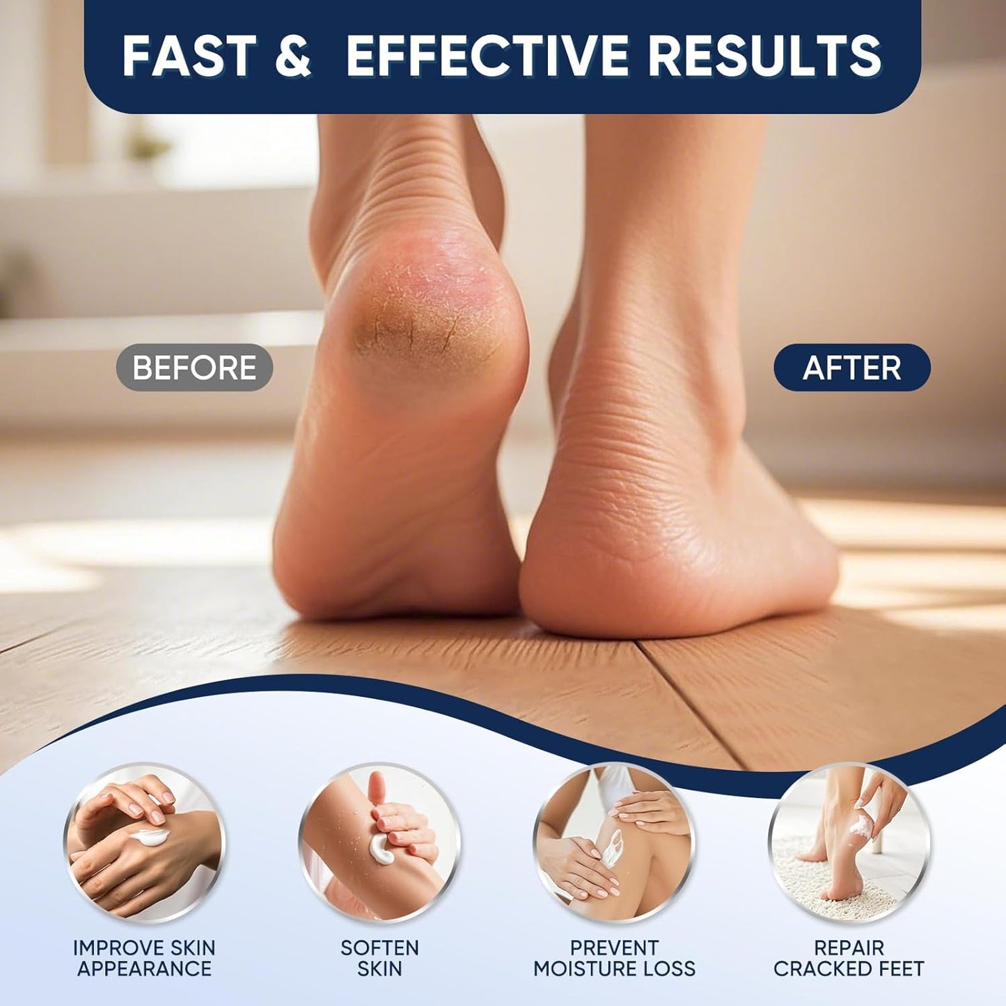 Urea Cream 40 Percent for Feet Maximum Strength, Urea Cream 40% Plus Salicylic Acid 2%, Foot & Hand Cream for Dry Cracked