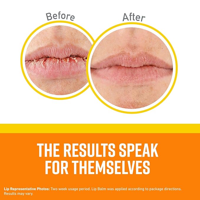 O'Keeffe's Lip Repair SPF 35 Lip Balm Stick, (Pack of 2)