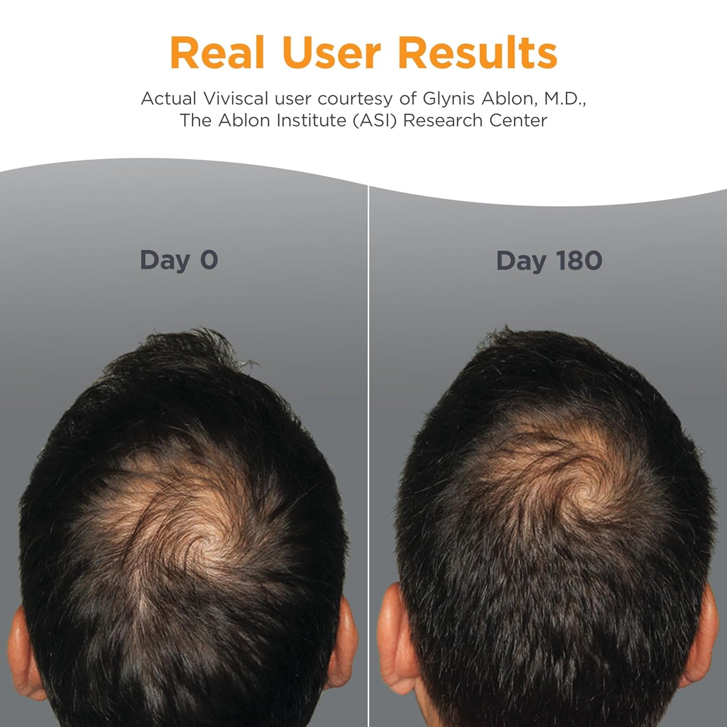 Viviscal Men's Hair Growth Supplements for Thicker Fuller Hair, Clinically Proven Collagen Complex, 180 Tablets 3 Month Supply