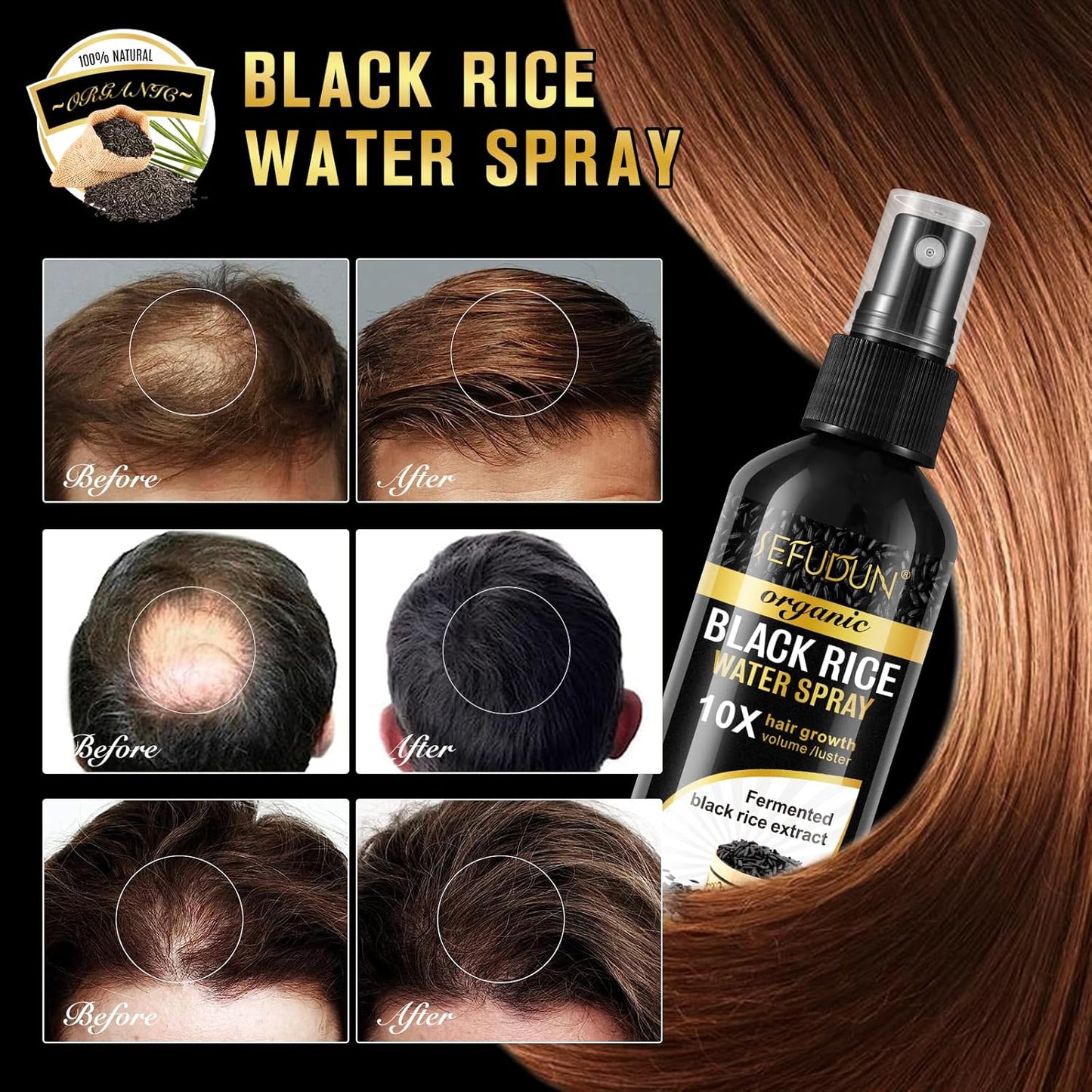 Organic Black Rice Water Spray for Hair Growth, A Solution with Castor Oil & Ginger Root Extract for Thicker, Fuller Hair, Targets Hair Loss and Repairs Damage 100ml/3.2 fl.oz (1 PC)