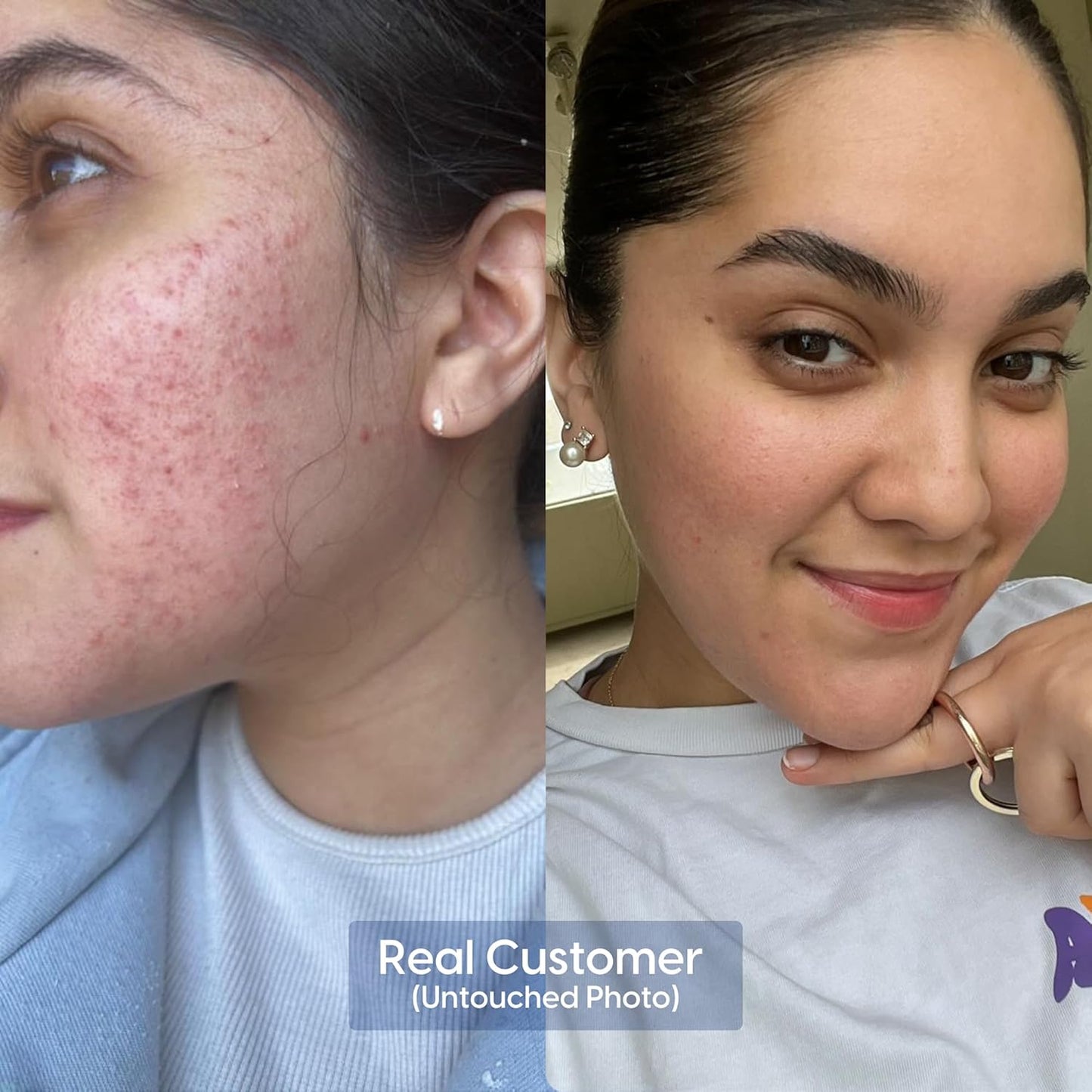 Strive - Anti-aging Retinal Serum - 0.1% Retinaldehyde, 10% Peptides & 2% Vitamin C E Ferulic Face Serum. Brightening, Firming, Wrinkle & Fine Line Reducing - Fragrance Free Anti aging Skincare - 30mL