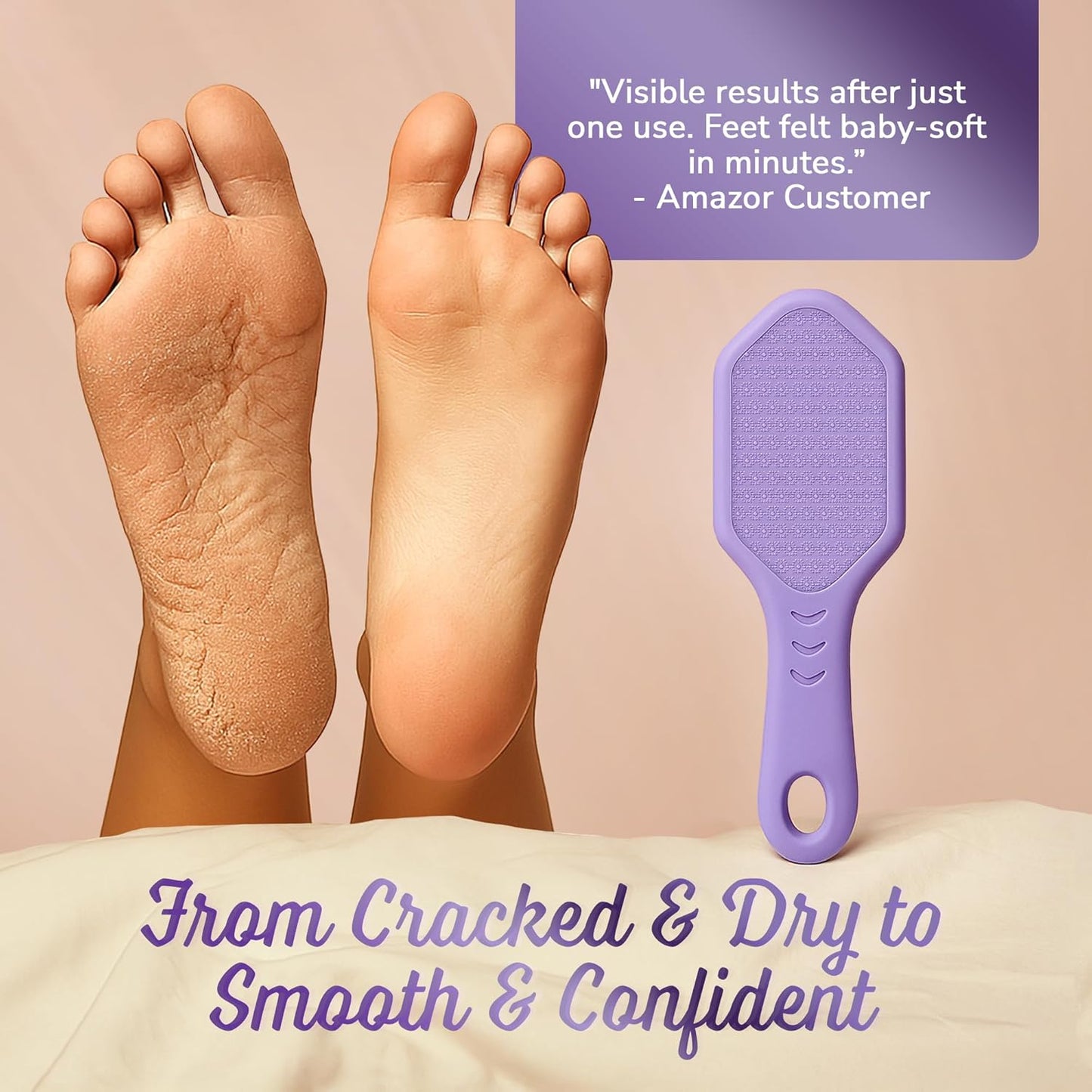 Silicone Foot Callus Remover - Nano Glass Foot File for Dead Skin and Cracked Heels - Callus Remover for Feet & Hard Skin - Ergonomic Foot Scrubber & Exfoliator for Soft, Smooth Feet - Purple