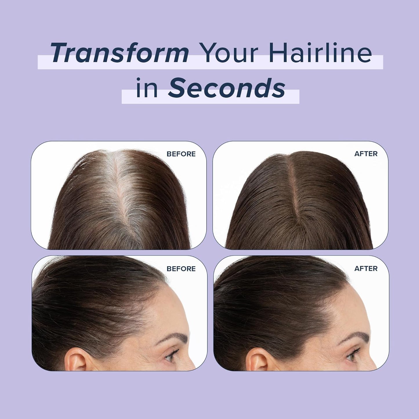 TRUHAIR Root & Scalp Cover Up Pressed Powder Compact Refill, Waterproof, Weightless Hair Coverage & Bald Spot Concealing, Root Touch Up Hair Color for Gray Coverage & Thinning Areas, 0.35 Oz (White)