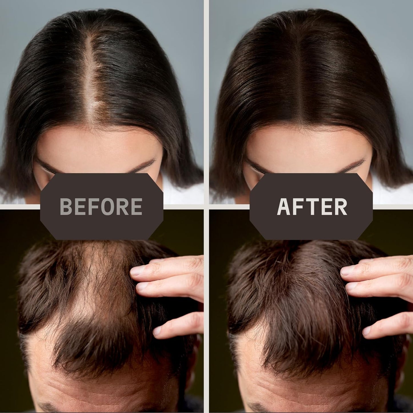 Striking Viking Hair Fibers for Thinning Hair - 28 g, Medium Brown - Bald Spot Cover Up & Sweat-Proof Thickening Powder