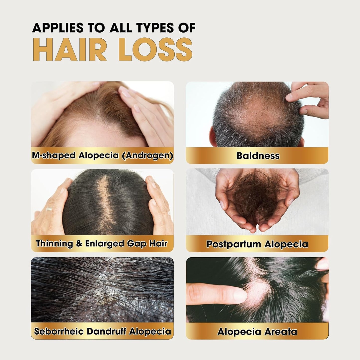 Herb Hair Growth Oil Spray for Women Men - Dry Scalp Hair Growth Serum for Combat Hair Loss, Strengthening, Boost Scalp Health to Stimulate Thinning Hair Regrowth Thicker & Longer