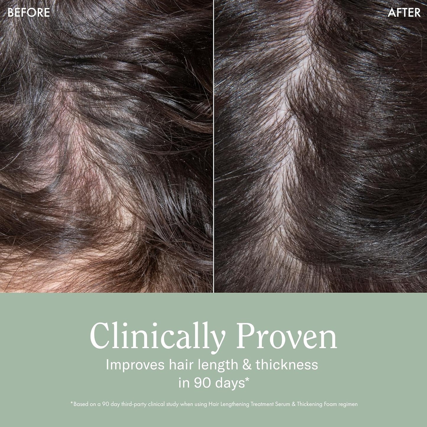 Rizos Curls Hair Lengthening Treatment Serum, Fortifies At Root for Healthy Scalp Microbiome Promoting Length, Supportes Longer Stronger Hair, 4.2 oz